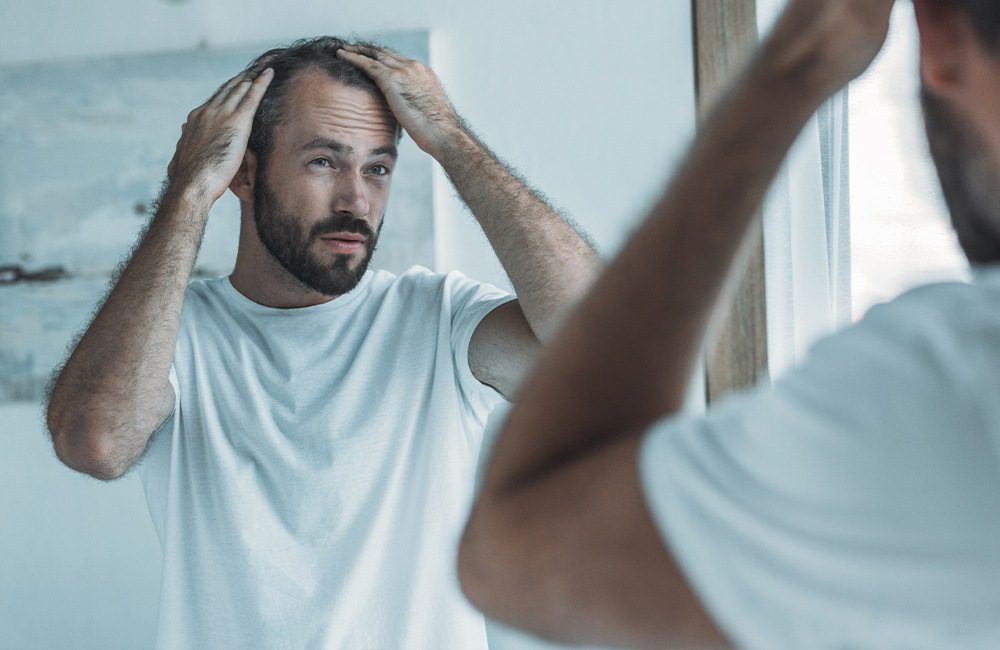 Hair Transplants: Everything You Should Know Before Getting One