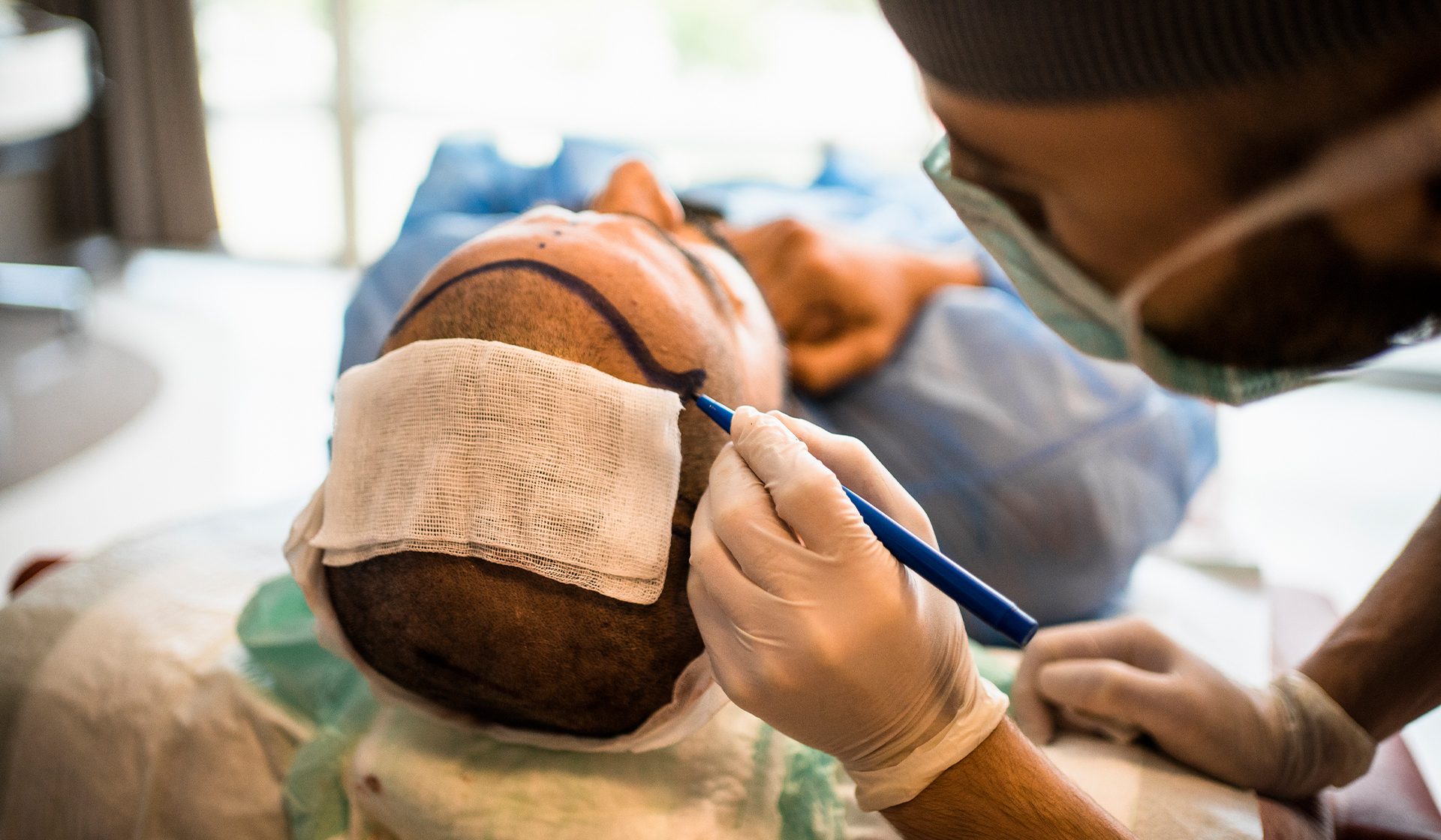 Turkey Hair Transplant: Don't Get One Without Reading This